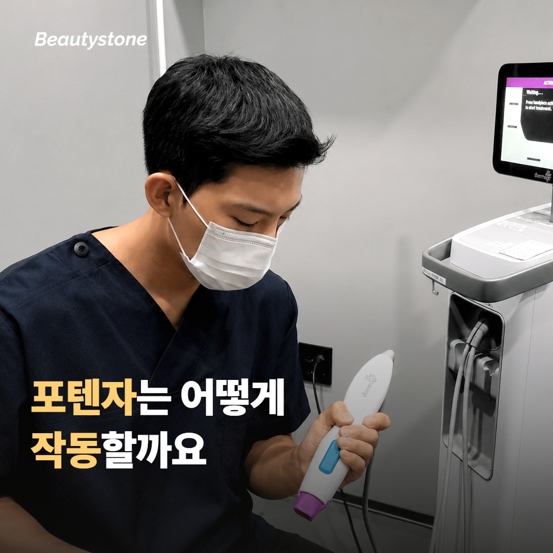 포텐자는 어떻게 작동하길래 회차가 필요할까요