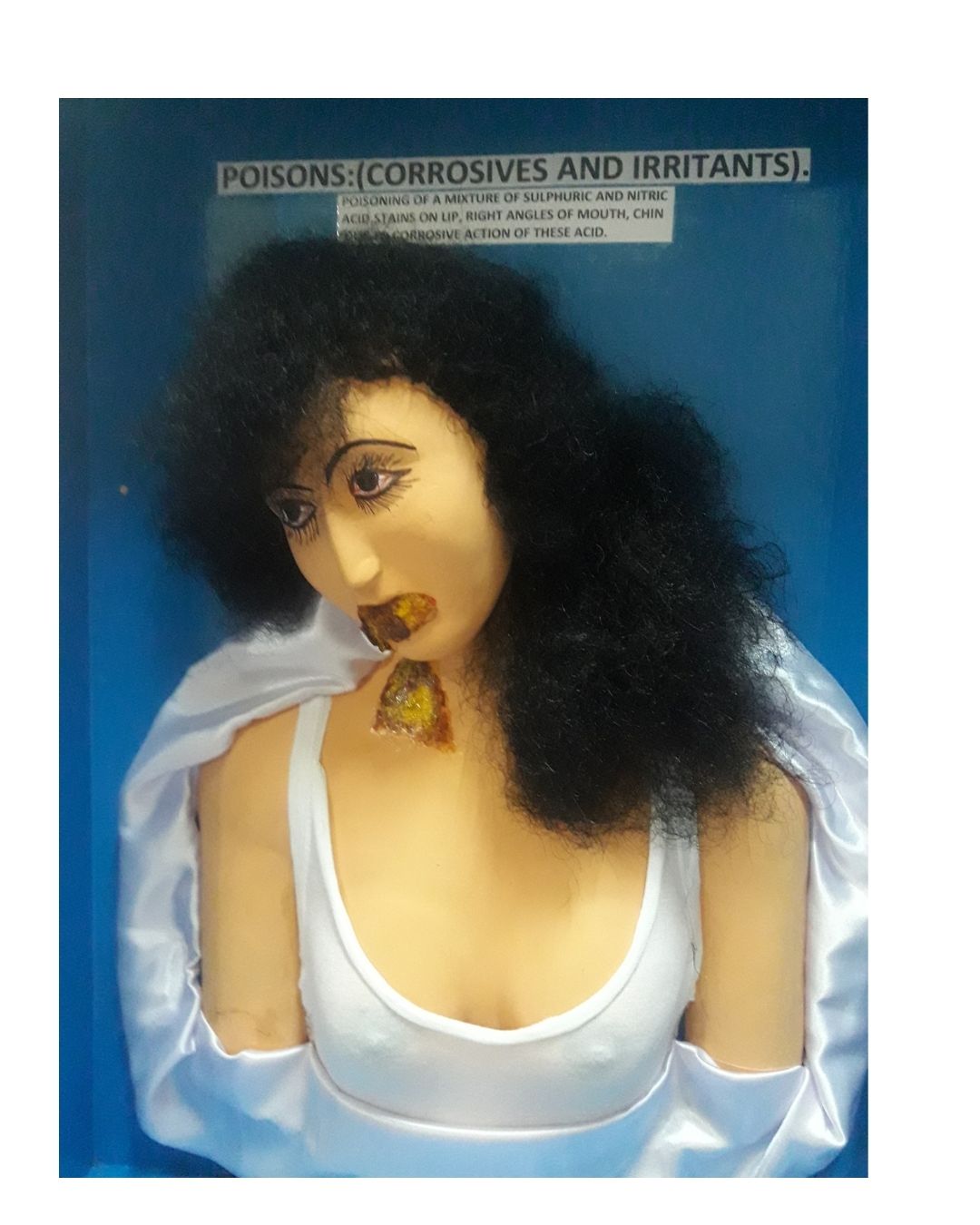 Poisons (Corrosives and Irritants)