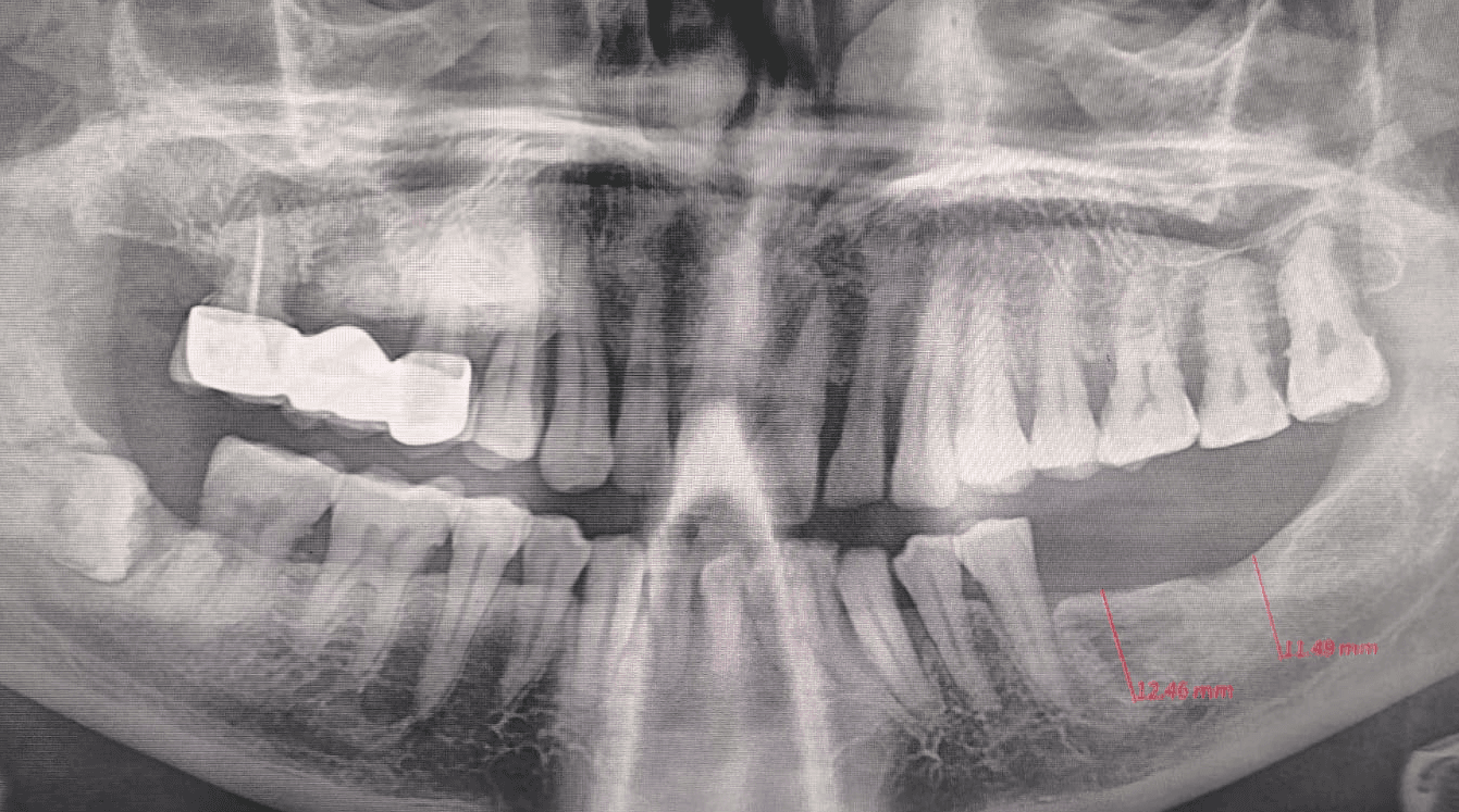 Before Image