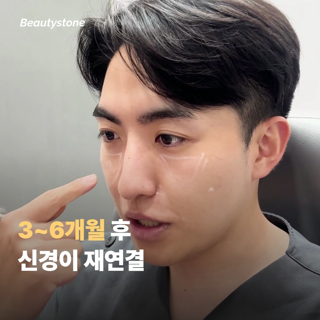 보톡스가 끼어드는 방식