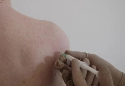 Shoulder joint injection