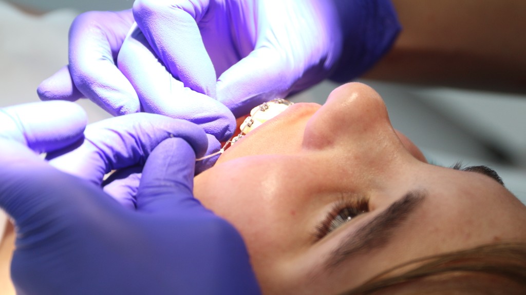 Doktorka upravuje fixný ortodontický aparát