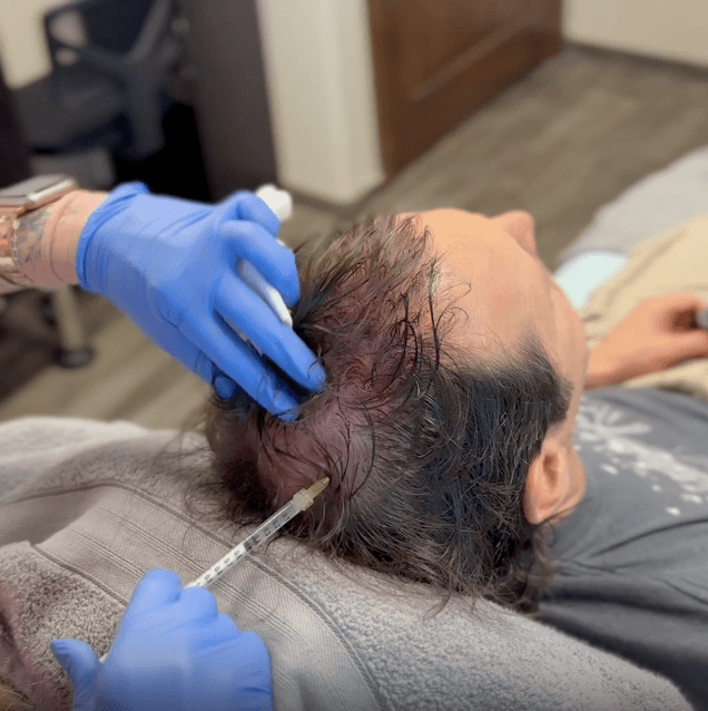 Sage Revive Rochelle Park Stem Cell Hair Restoration Photo