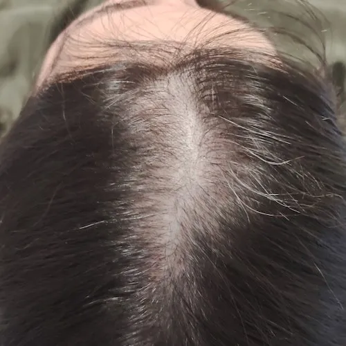 Hair Before