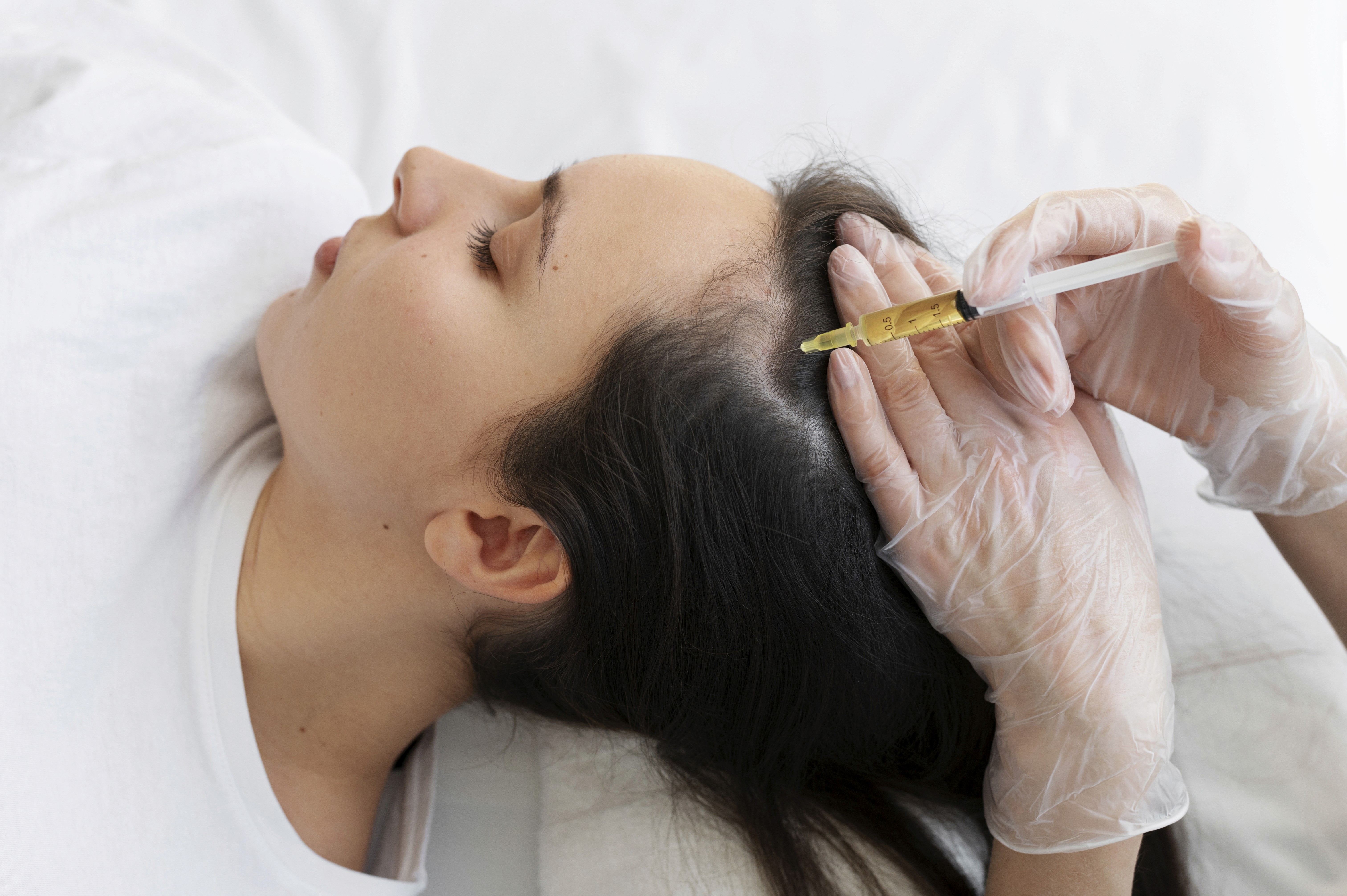Hair fall treatment in kondapur, best dermatologist, yuti clinics