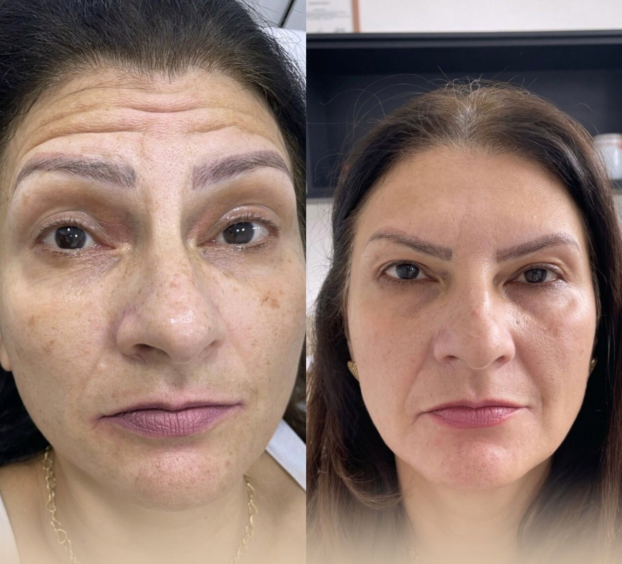 Skincare Tips for Every Season