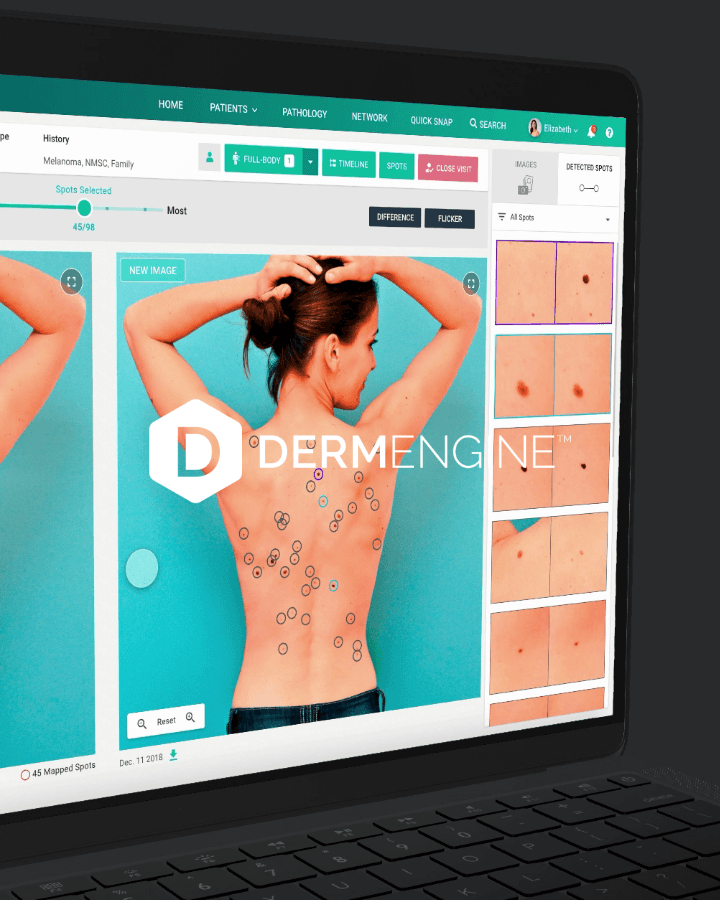 DERMENGINE app design