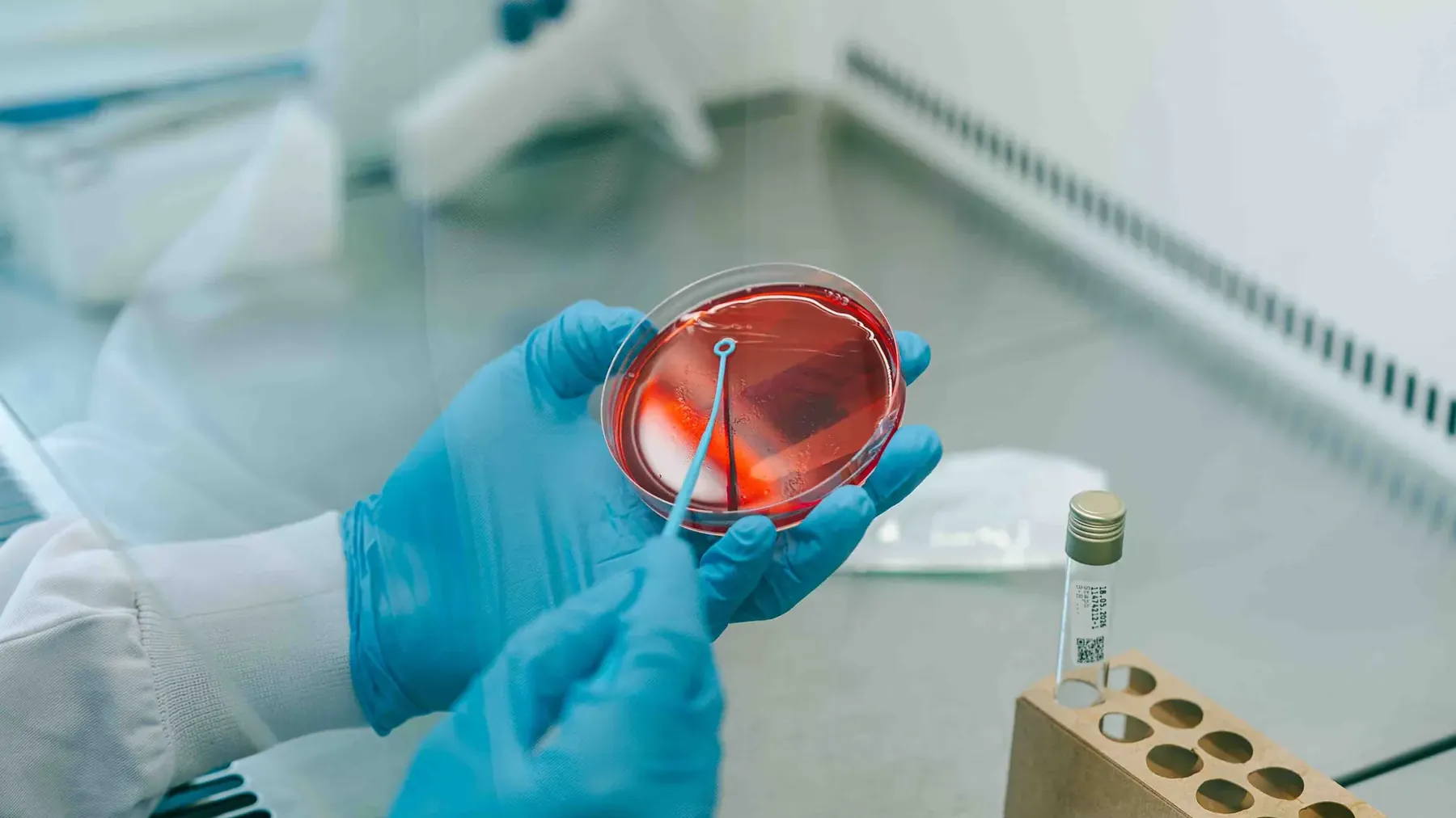 Gloved hands holding a petri dish with a blood agar sample and swab