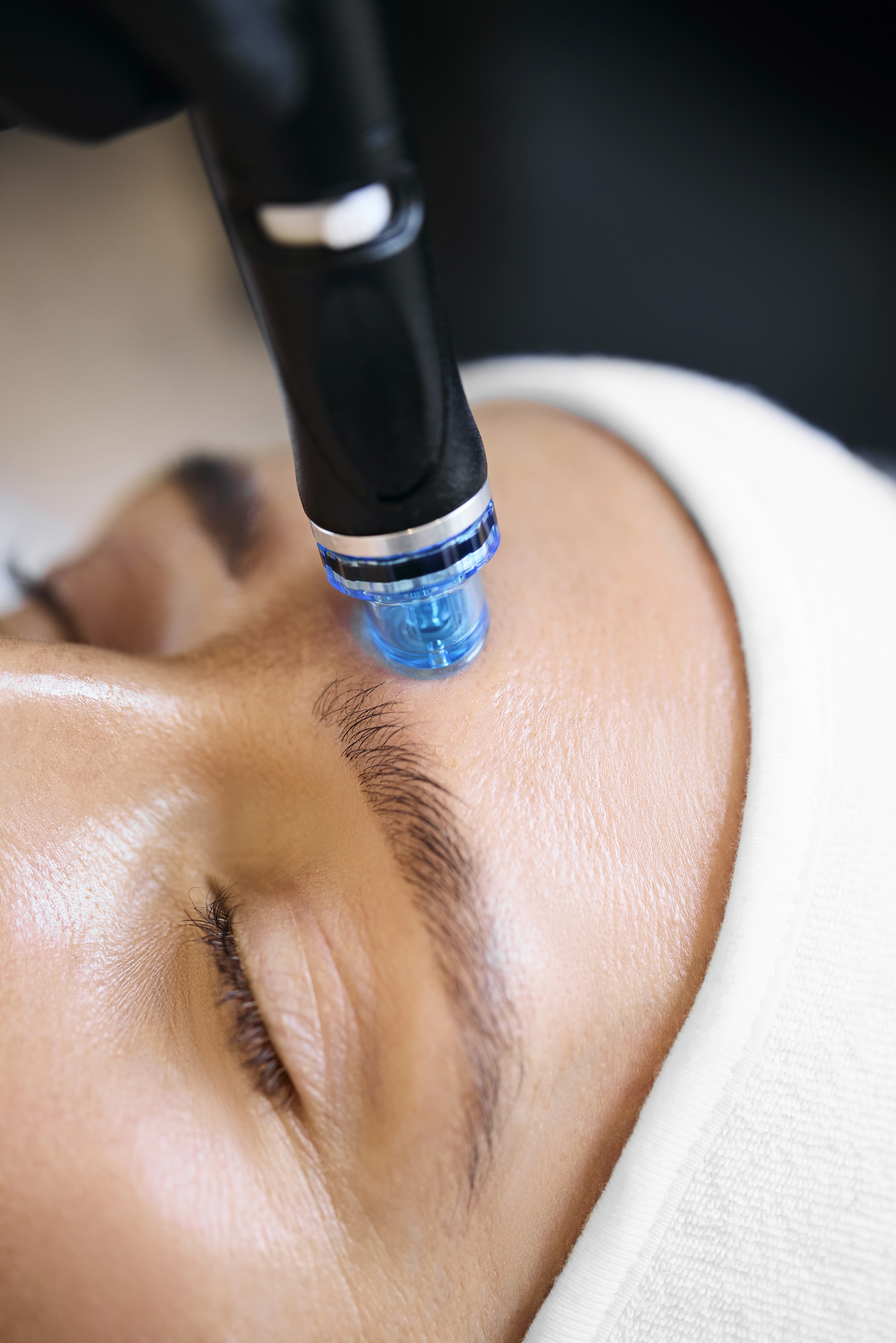 Close up image of hydrafacial treatment being performed on woman
