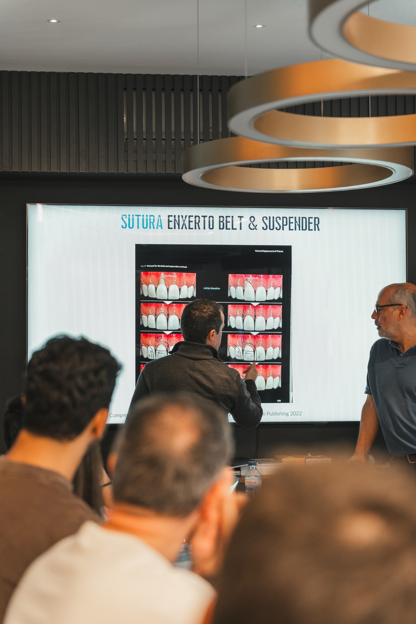 Preparação guiada e controlo de desgaste