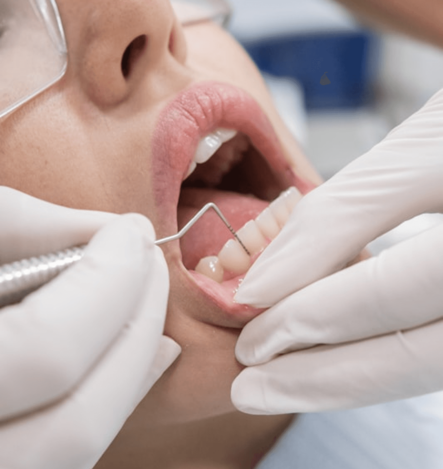 Dental professional examining patient’s teeth and gums with probe in clinic setting.