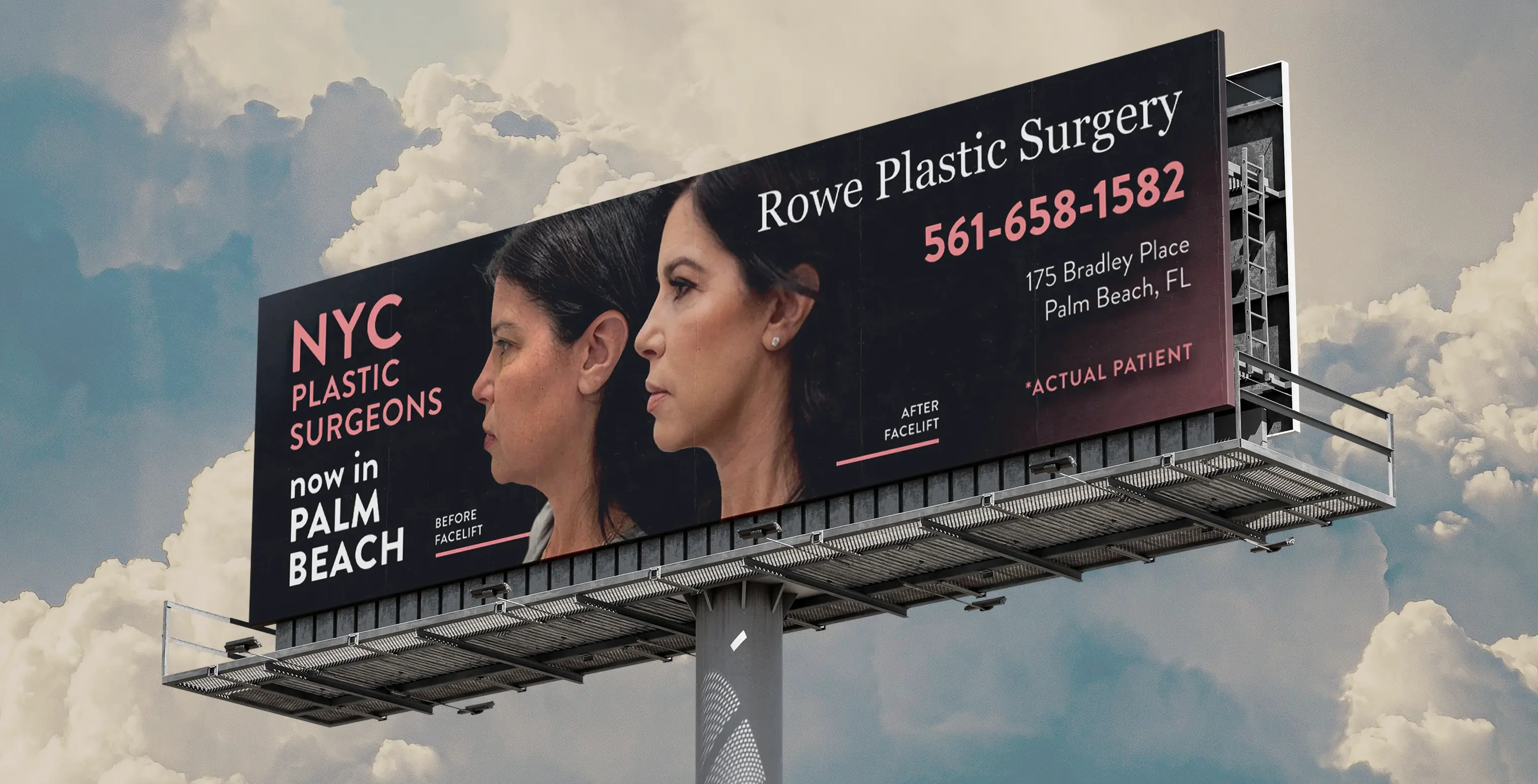 Print design for Rowe Plastic Surgery — outdoor billboard featuring a before-and-after patient portrait with location and contact information
