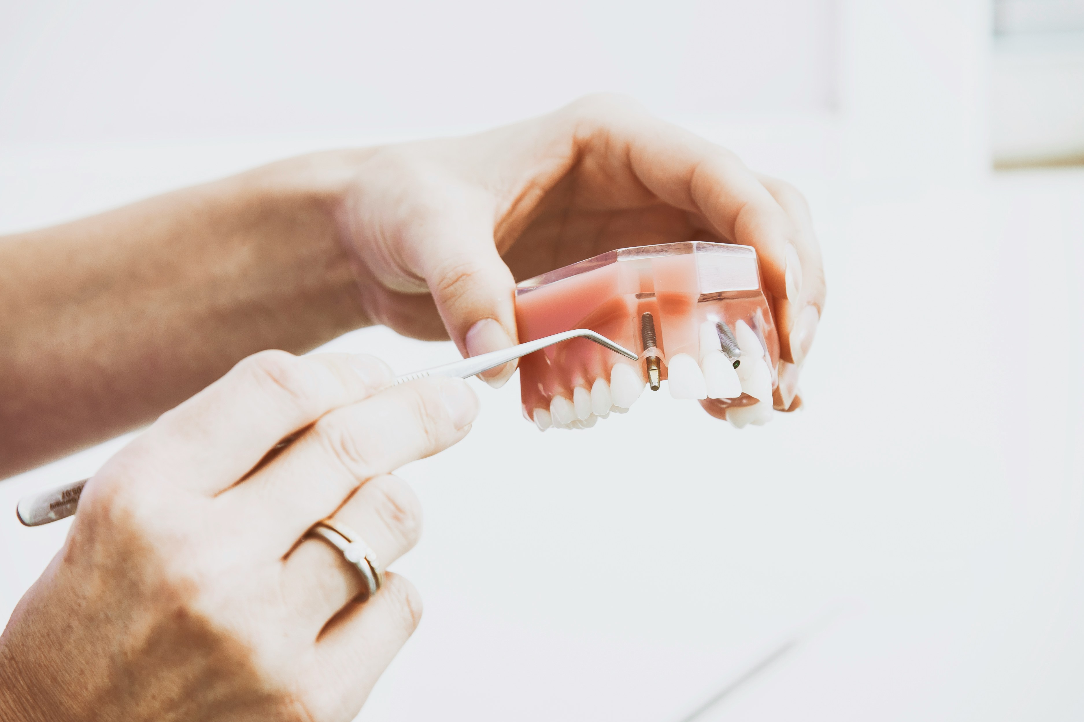 Dental model demonstrating the placement of dental implants with tools.