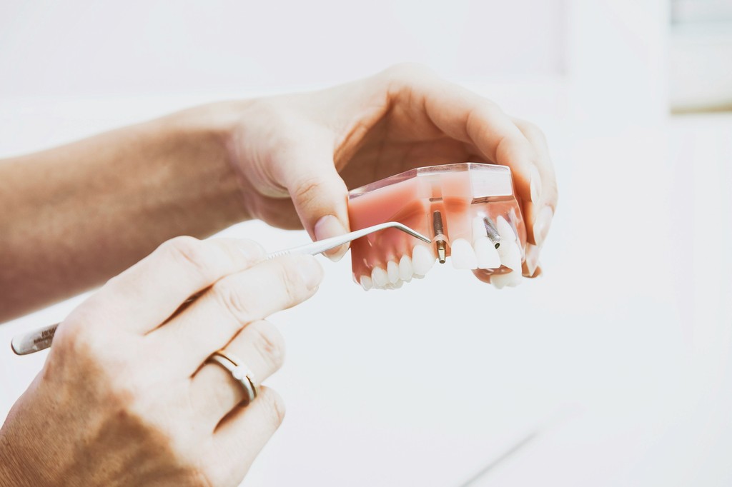 smyrna full mouth dental implants