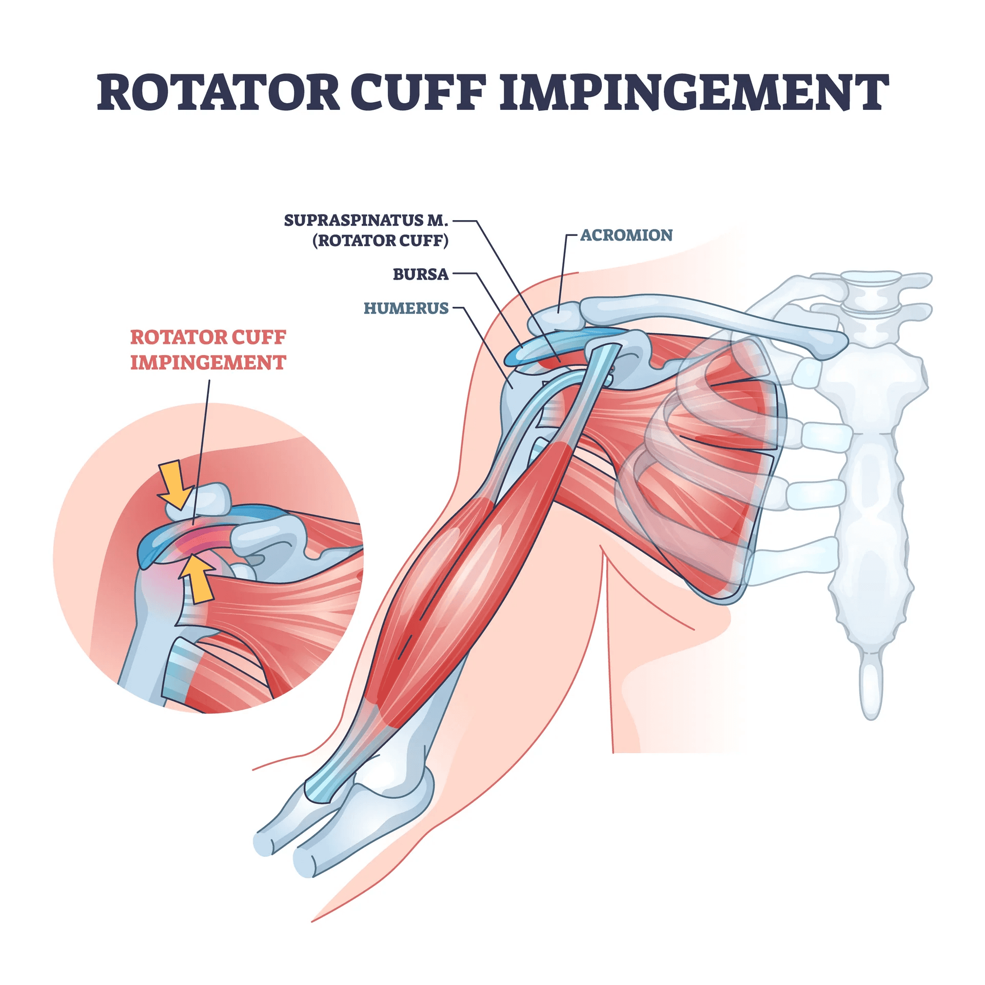  Physical Therapy Team Names - supra spinatus crew rotator