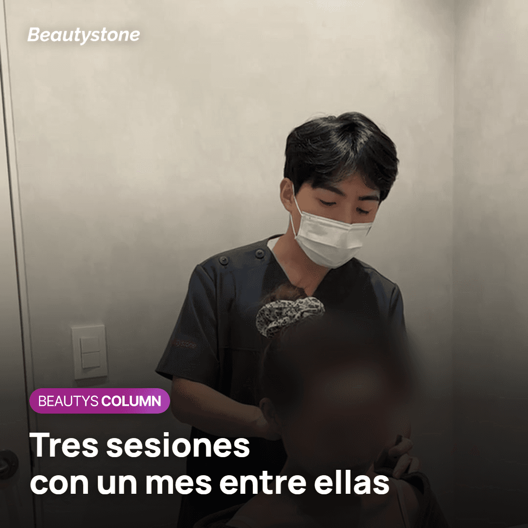 Número de sesiones de Rejuran y qué se decide en una visita