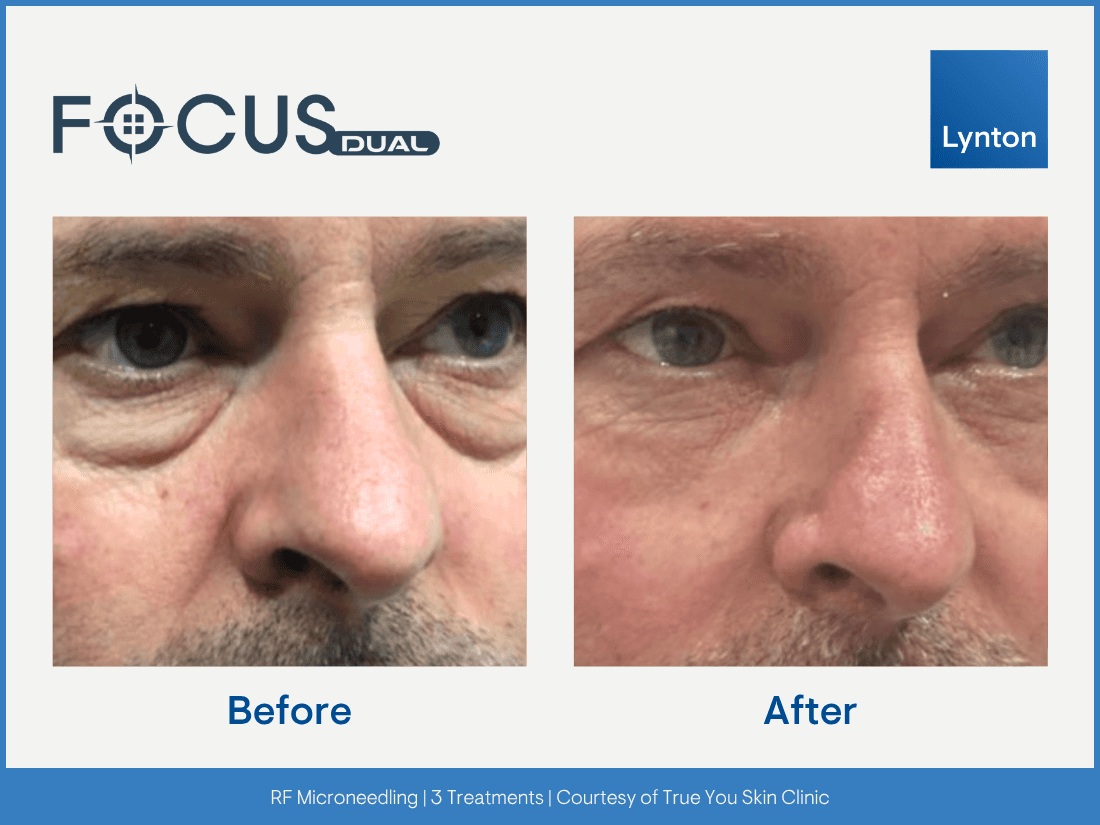 beauty product on a table