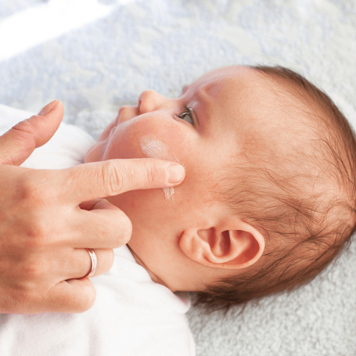 Solutions pour les bébé ayant de l'eczéma