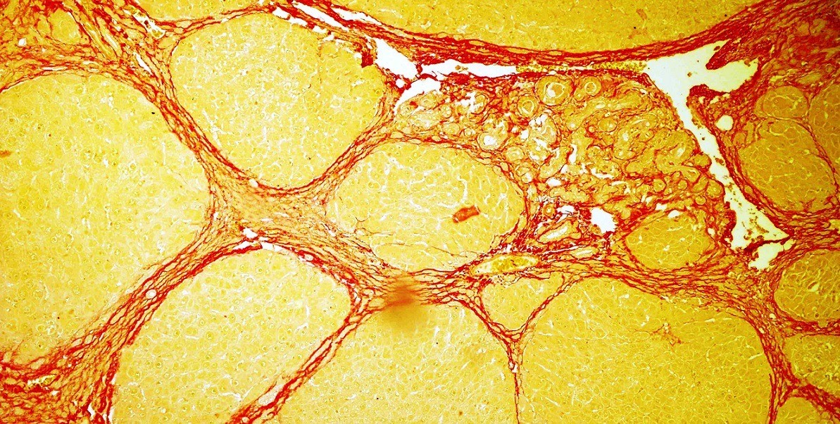 Close-up image from the scientific publication.