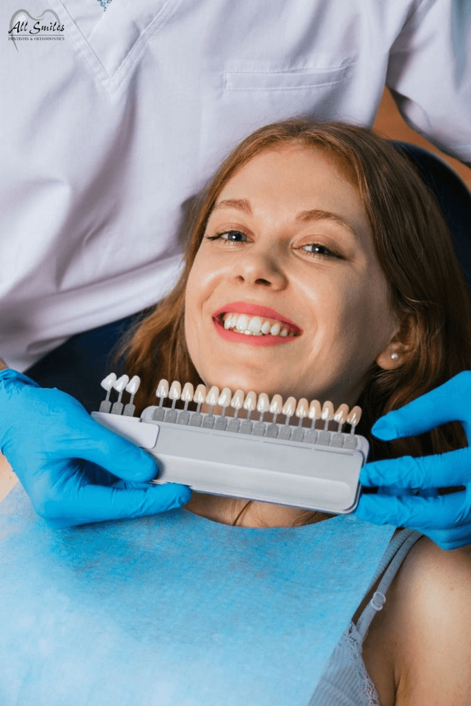 expert composite bonding