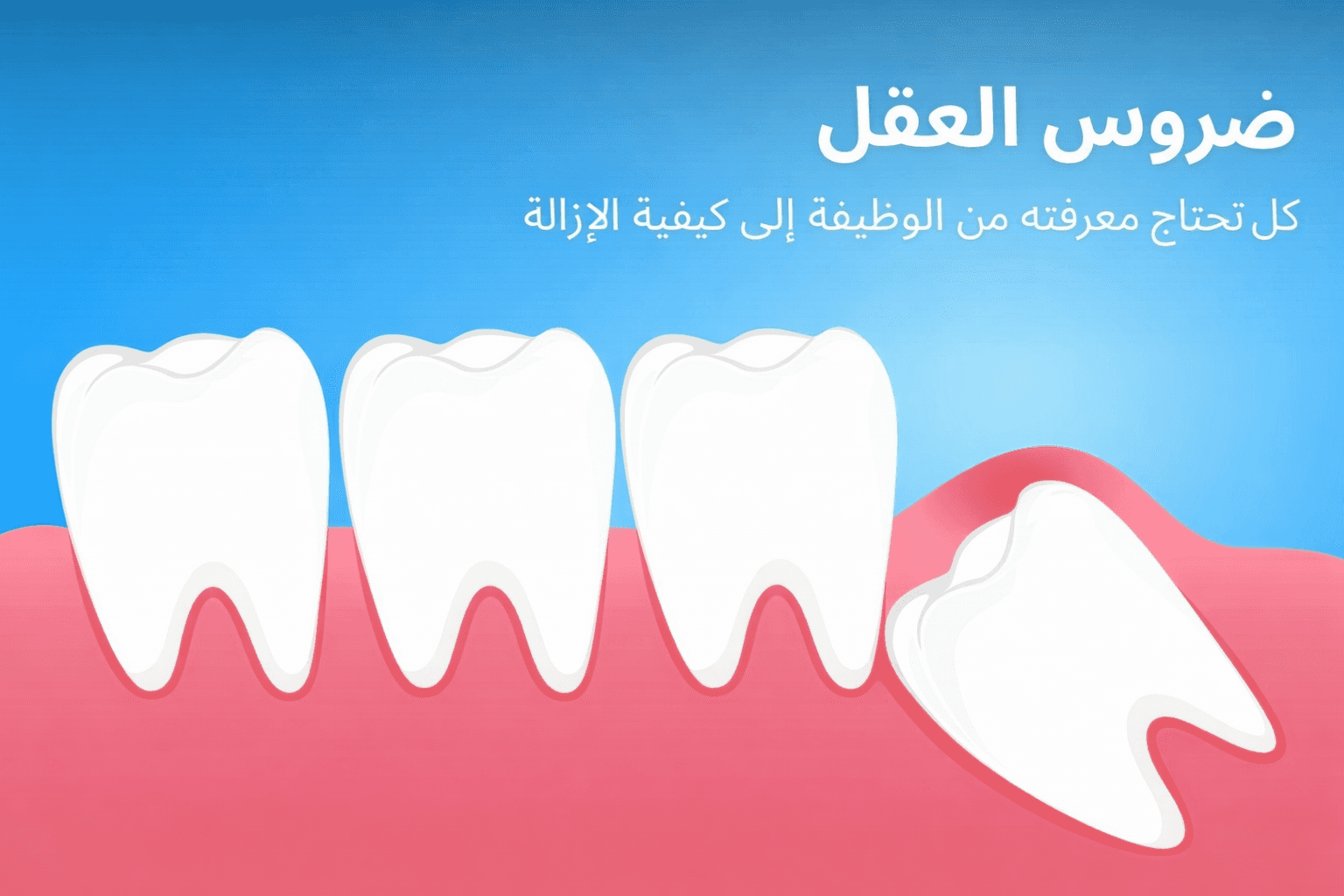 إنفوجرافيك يوضح المشاكل الشائعة الناتجة عن ضرس العقل