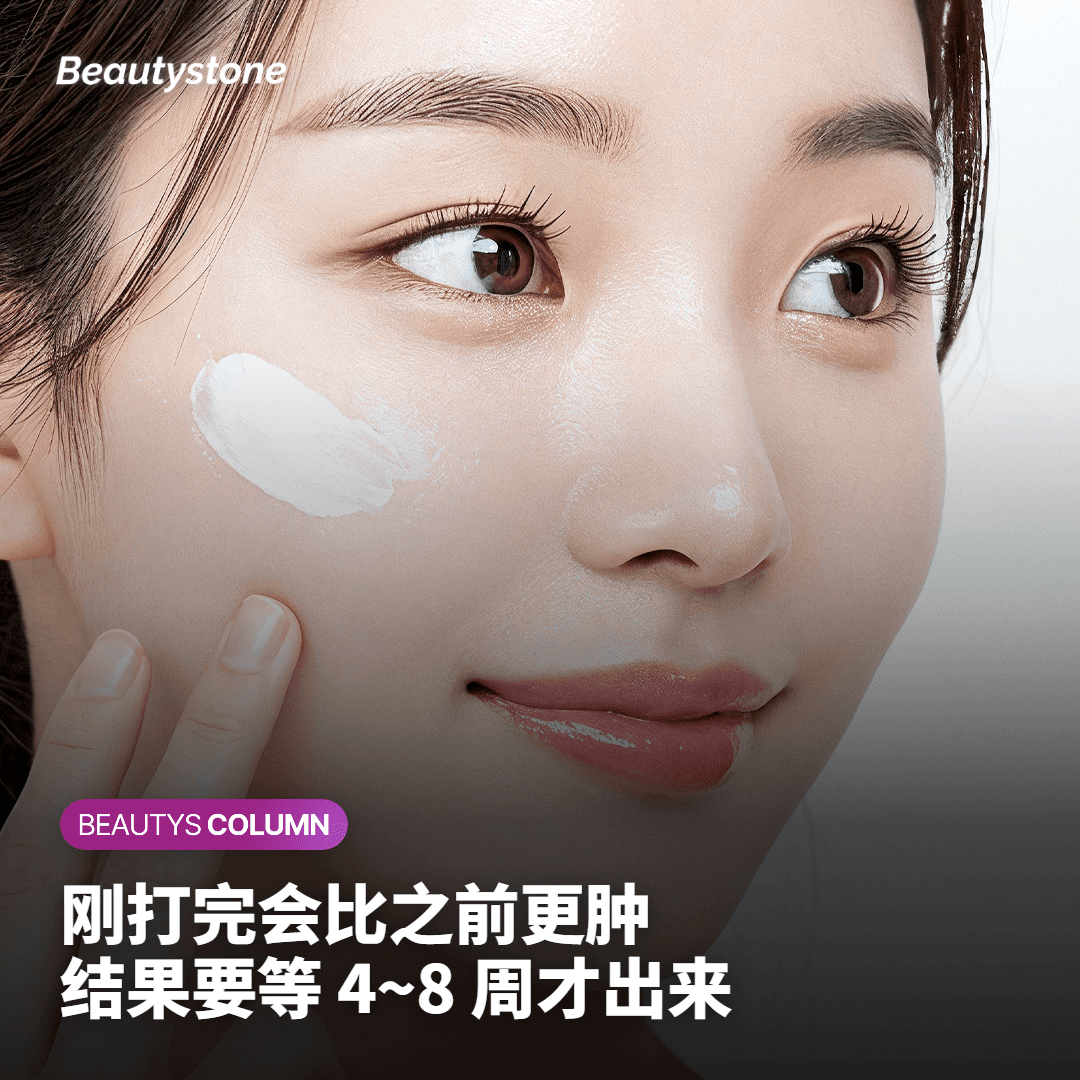 DCA 双下巴溶脂针治疗后变化过程