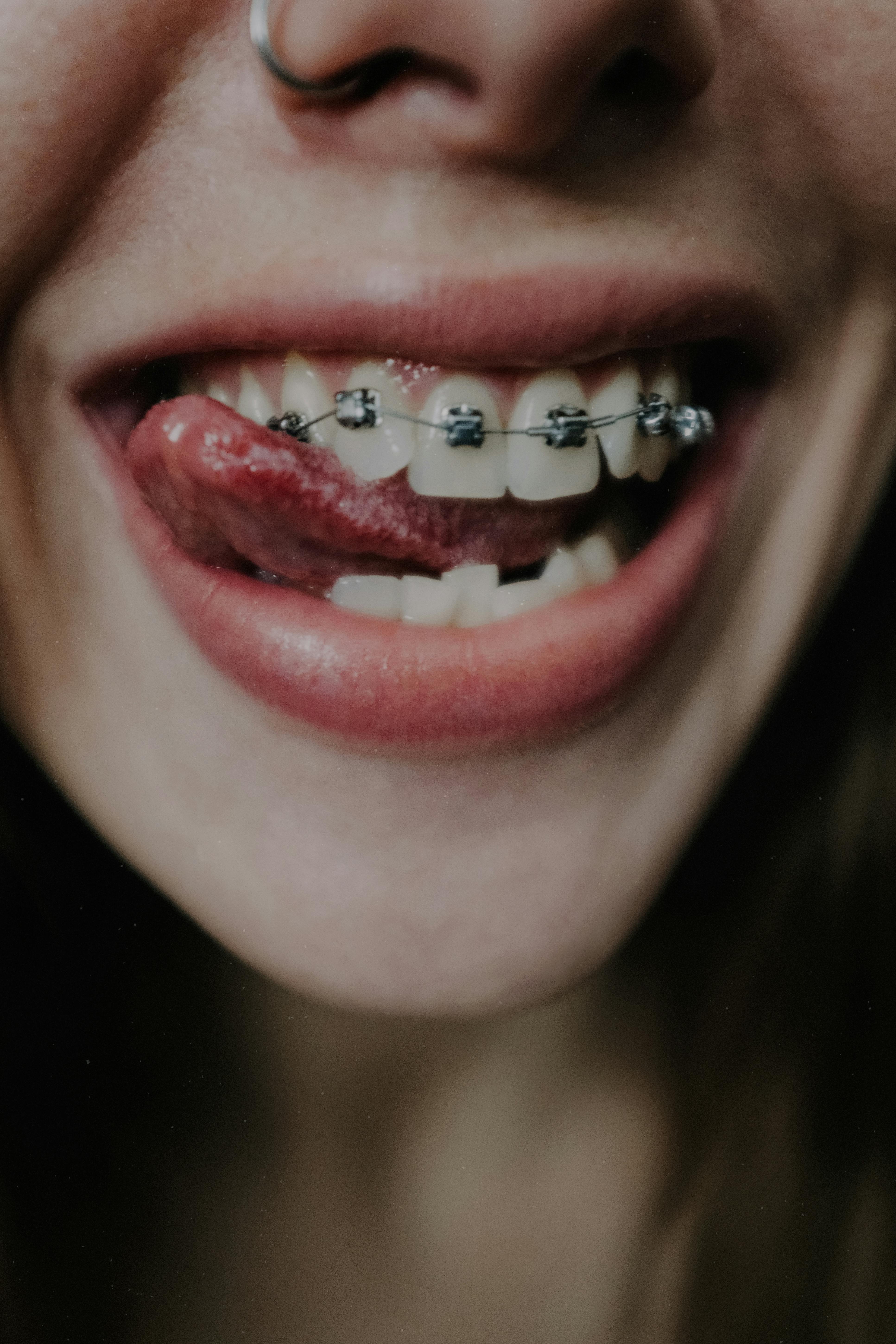 Comprehensive Orthodontic Treatments