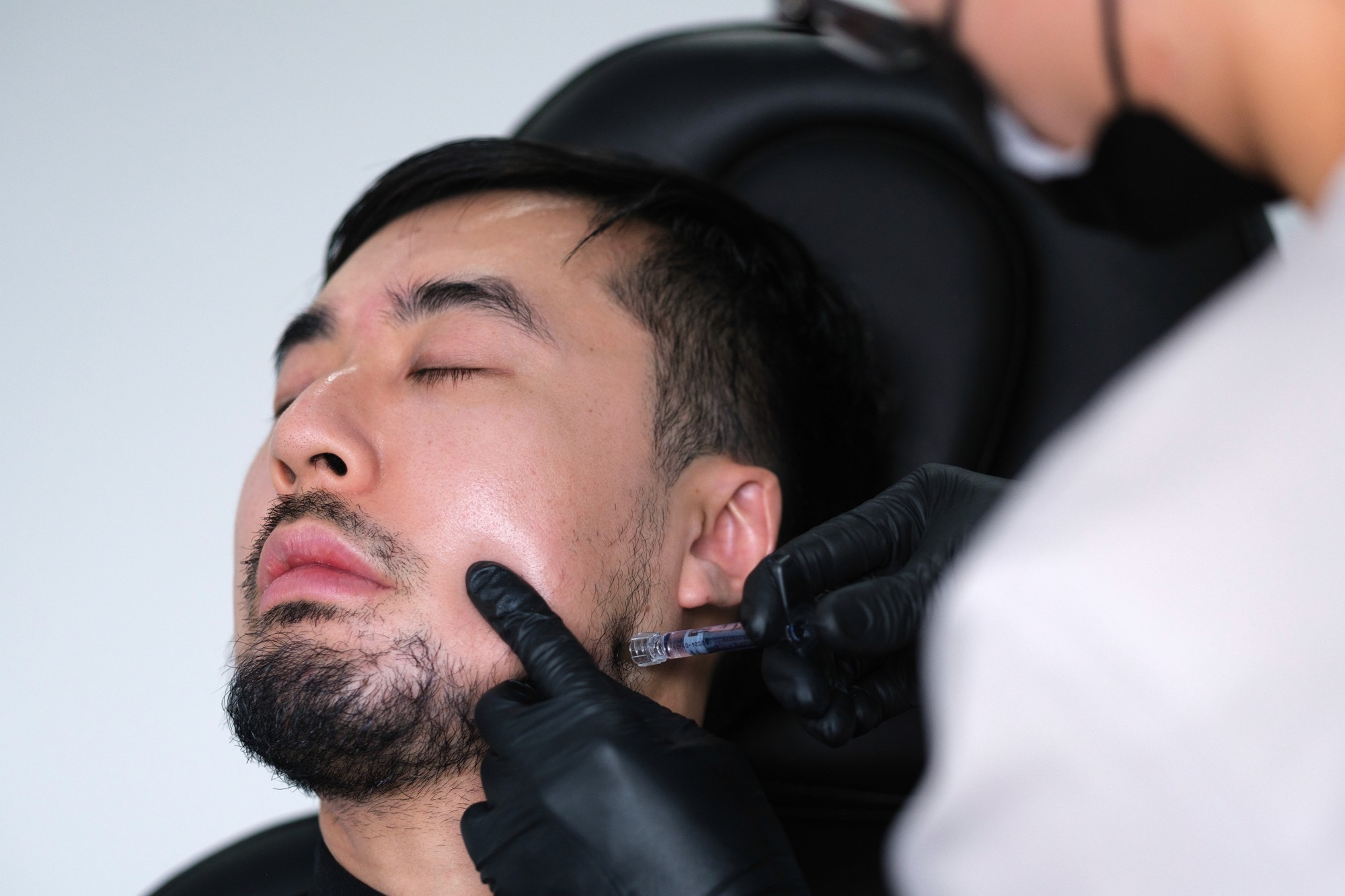 Fillers injections at a patient's jaw