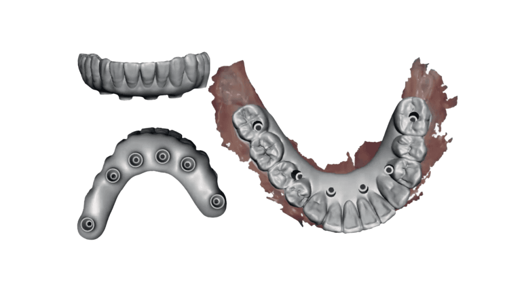 Digital Treatment Planning
