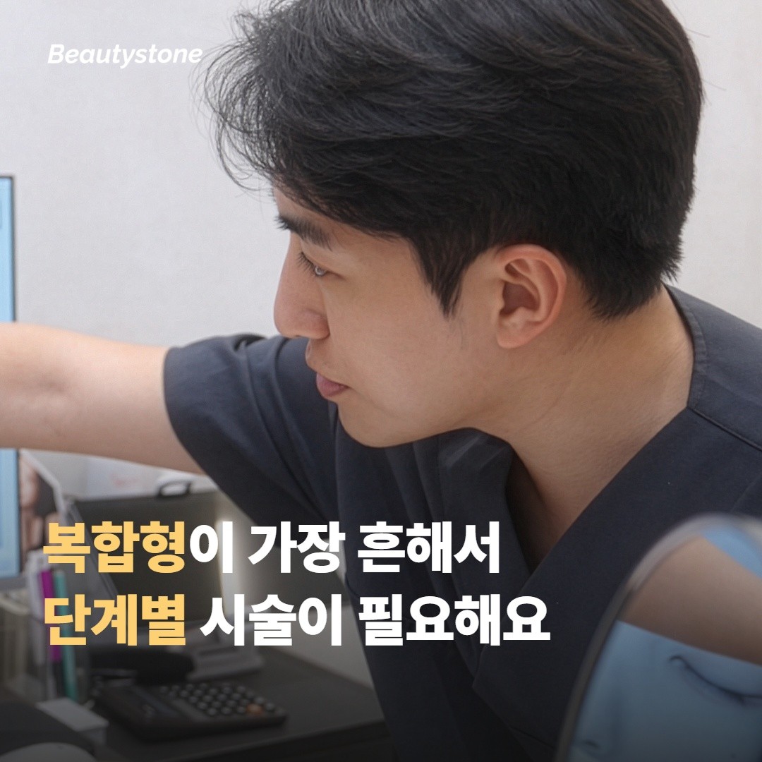 구조형 — 패임이 만드는 그림자