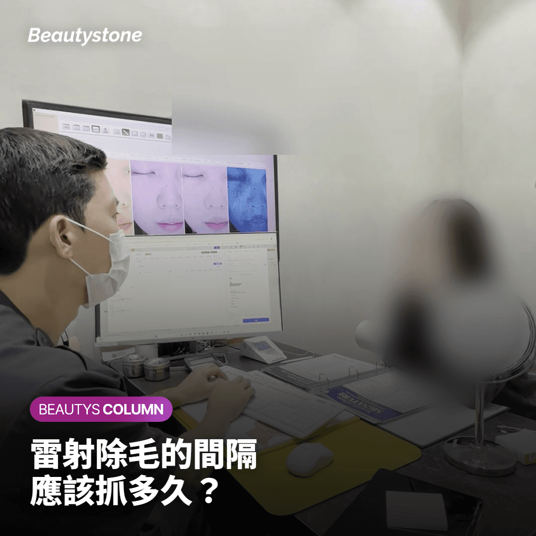 雷射除毛的間隔 應該抓多久?