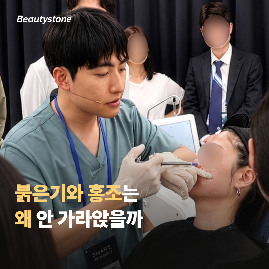 붉은기와 홍조는 왜 잘 안 가라앉을까요