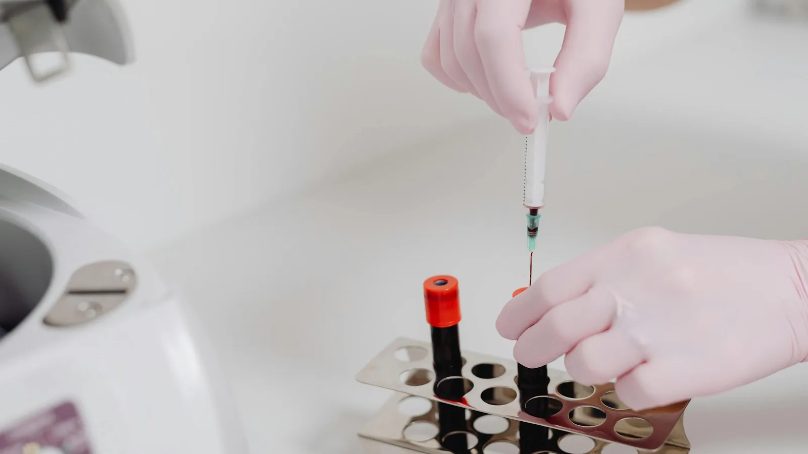 Wbc Differential Explained What Neutrophils Lymphocytes and Monocytes Reveal