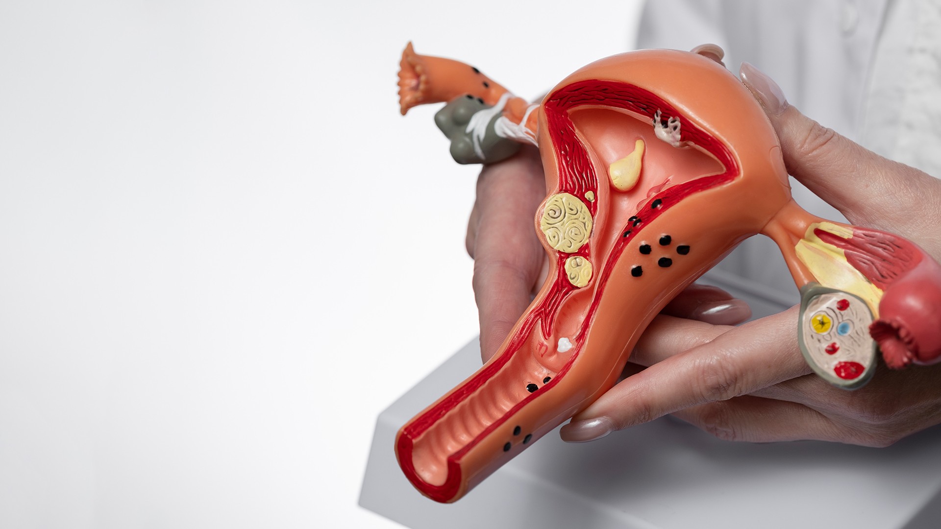 Understanding and Overcoming Repeated Implantation Challenges
