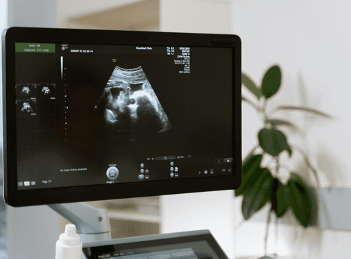 Smiling woman using a rose quartz Gua Sha stone and face roller for a facial massage