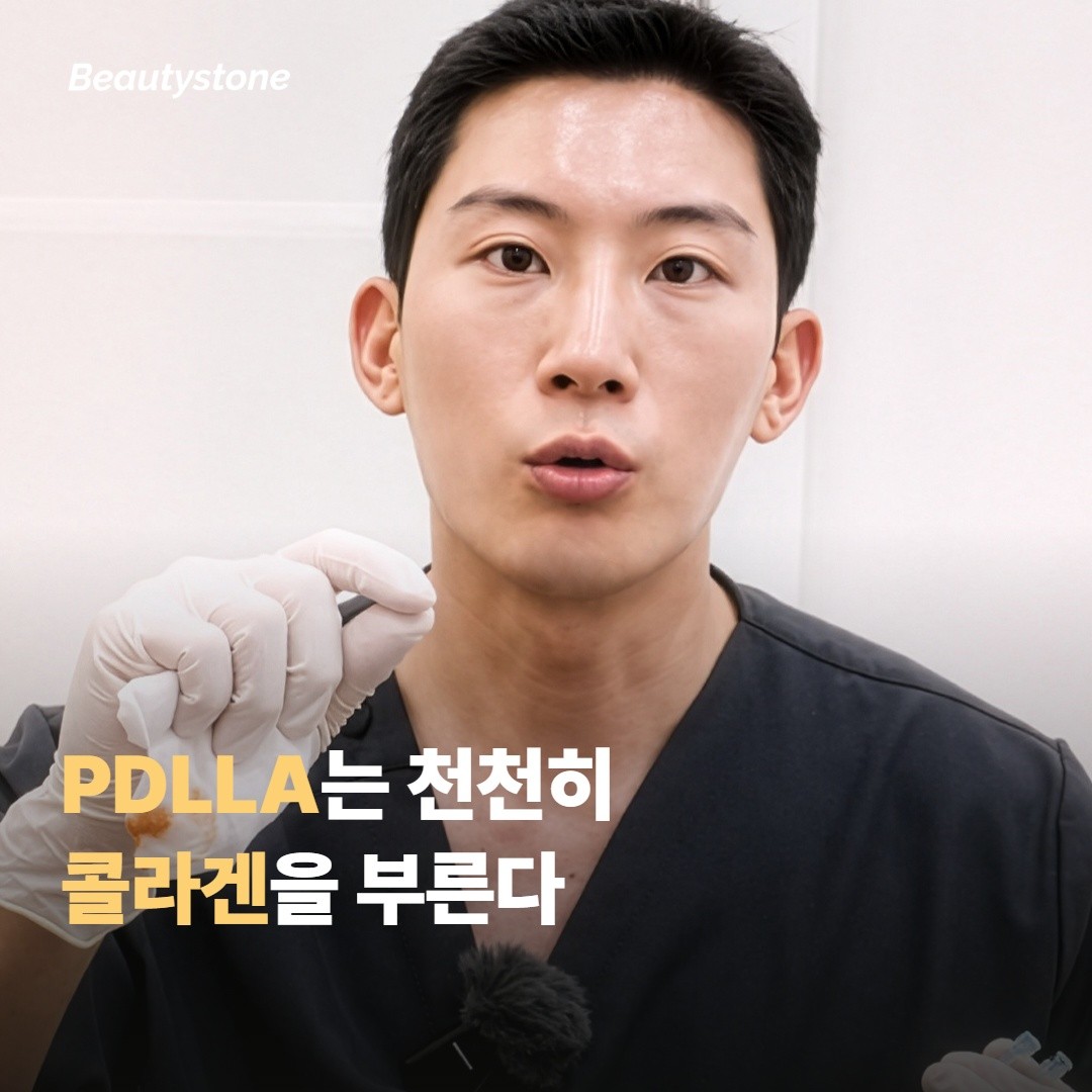 천천히 만들어지는 변화 — PDLLA의 일