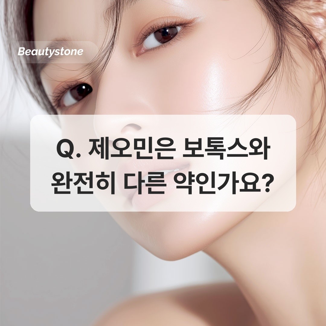 제오민 미간 보톡스 시술 전후 비교