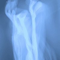 DEXA scan body composition testing for longevity medicine