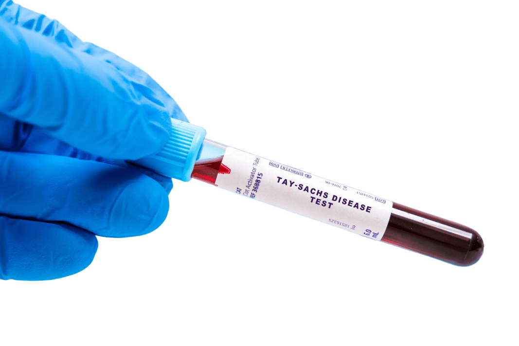 Tay-sachs blood test
