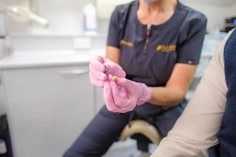A close-up photograph of a dentist, wearing a surgical mask and a dark grey tunic, holding a dental implant between their fingers.