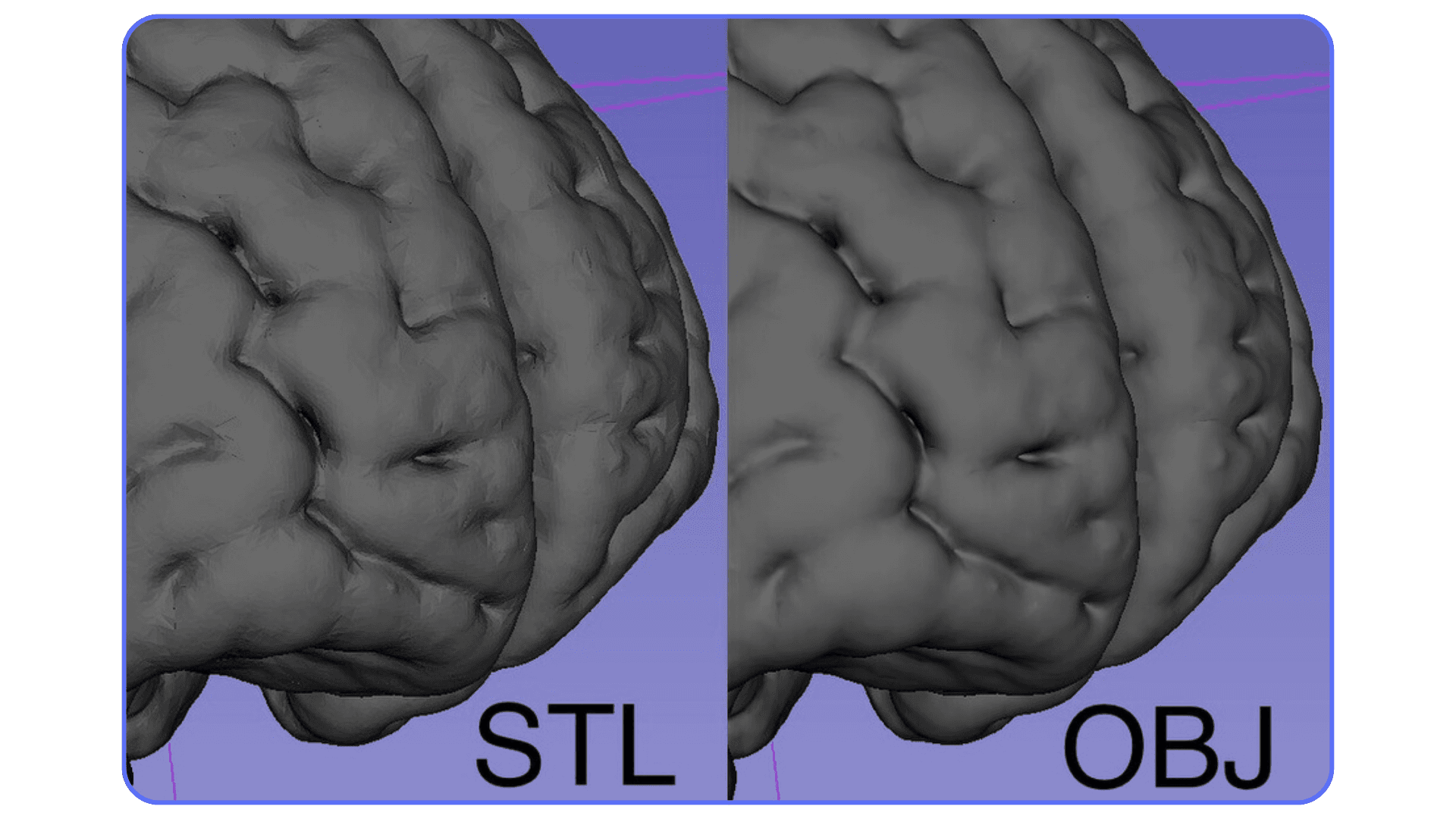 Close-up comparison of a 3D brain model exported as STL versus OBJ, highlighting differences in surface smoothness.