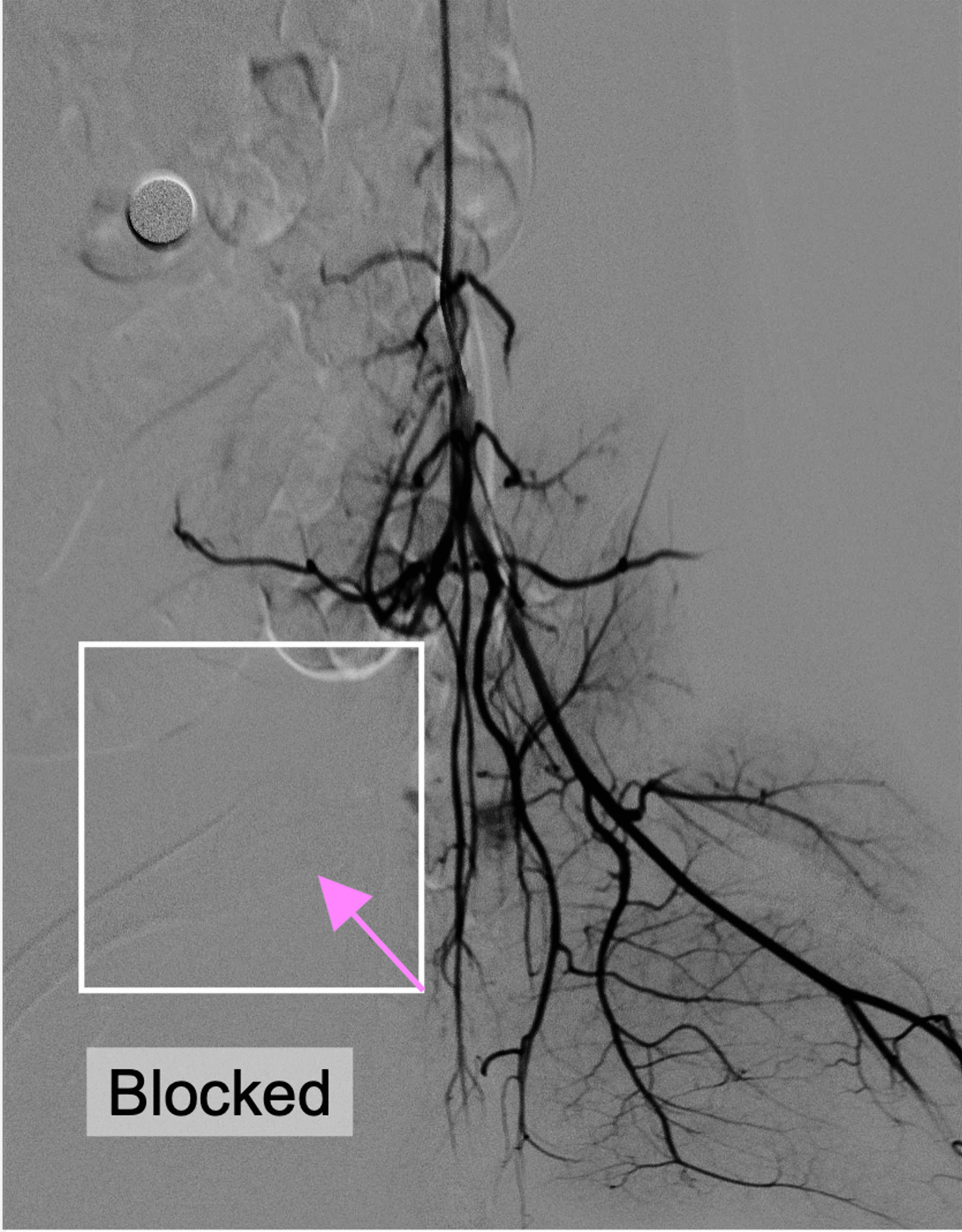 Coach explaining stuff to an athlete