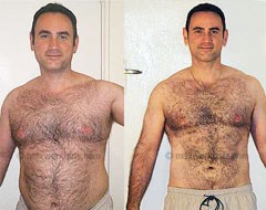 John's before and after photos