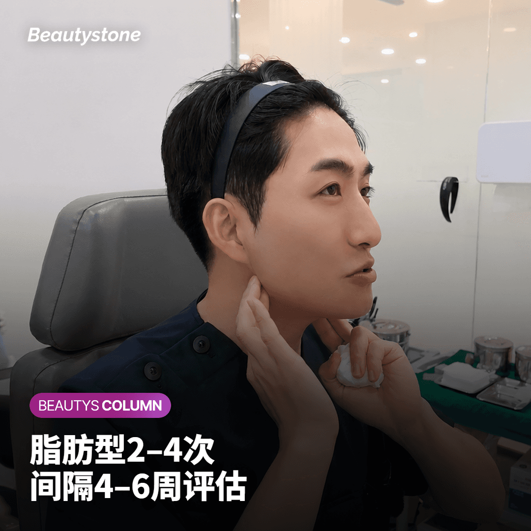Onda治疗后轮廓改善时间线示意，标注4至12周观察节点
