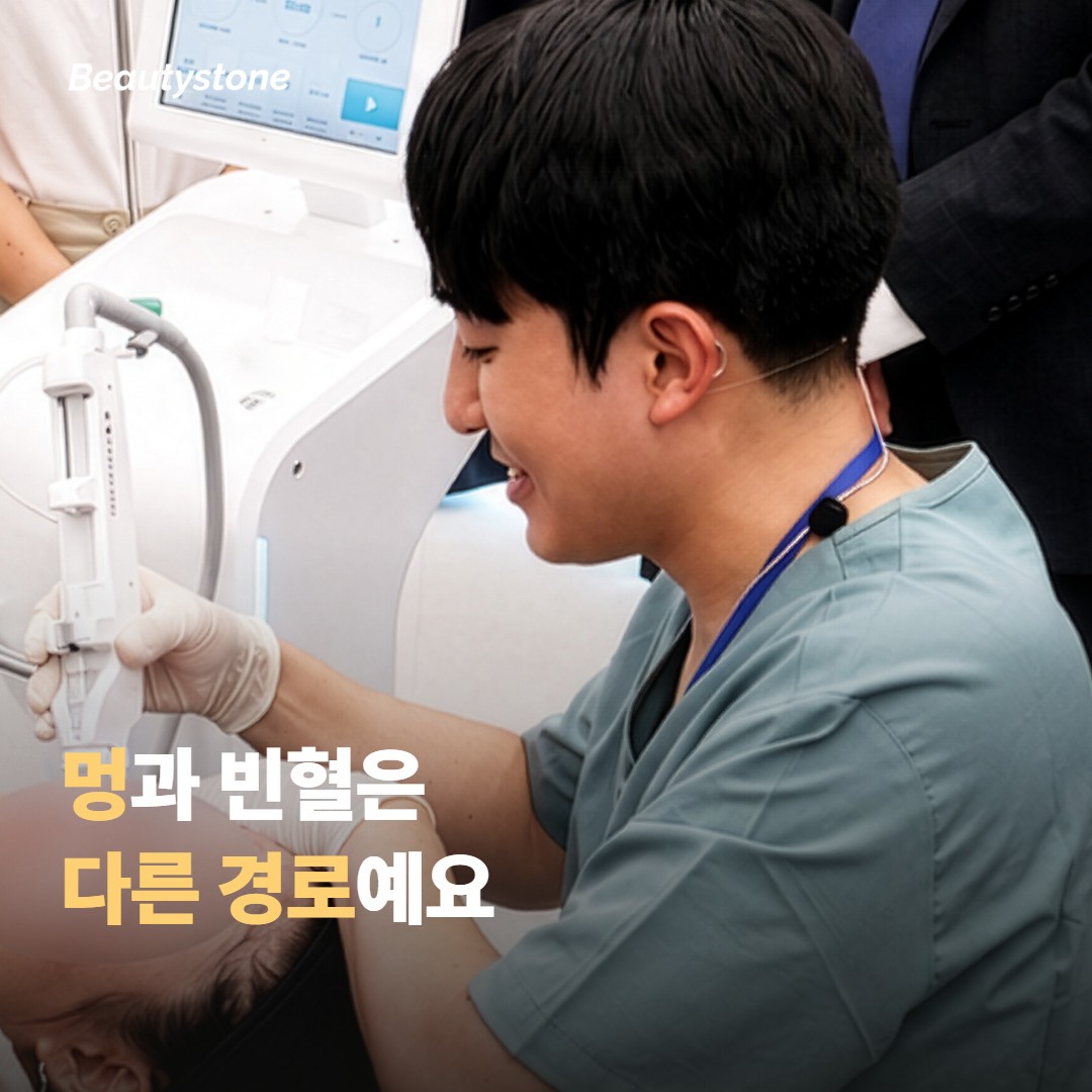 멍이 잘 드는 것과 빈혈은 같은 문제일까요