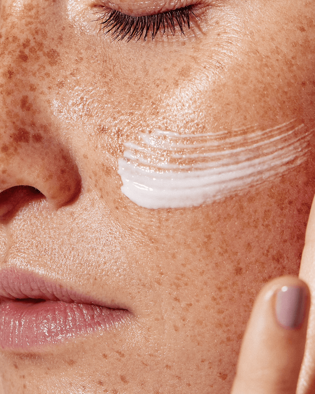 Close-up of dehydrated oily skin