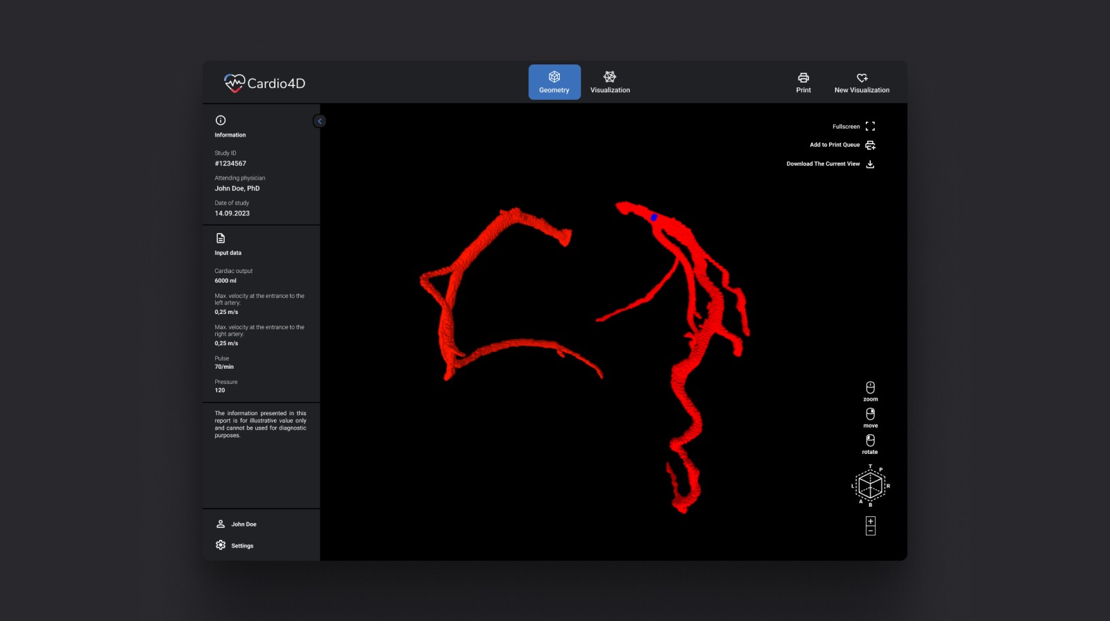 Phone showing Bloomy UI
