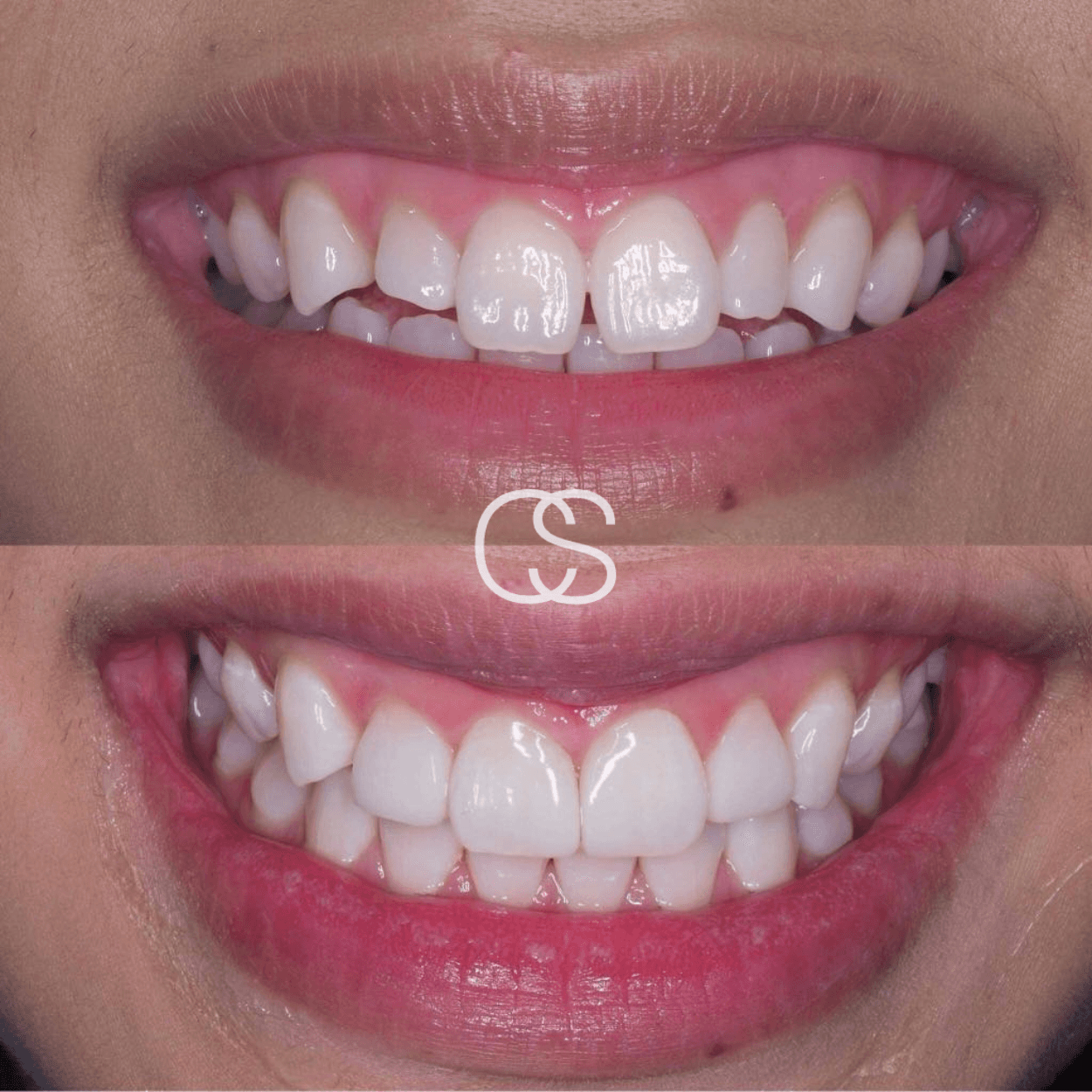 Before & After