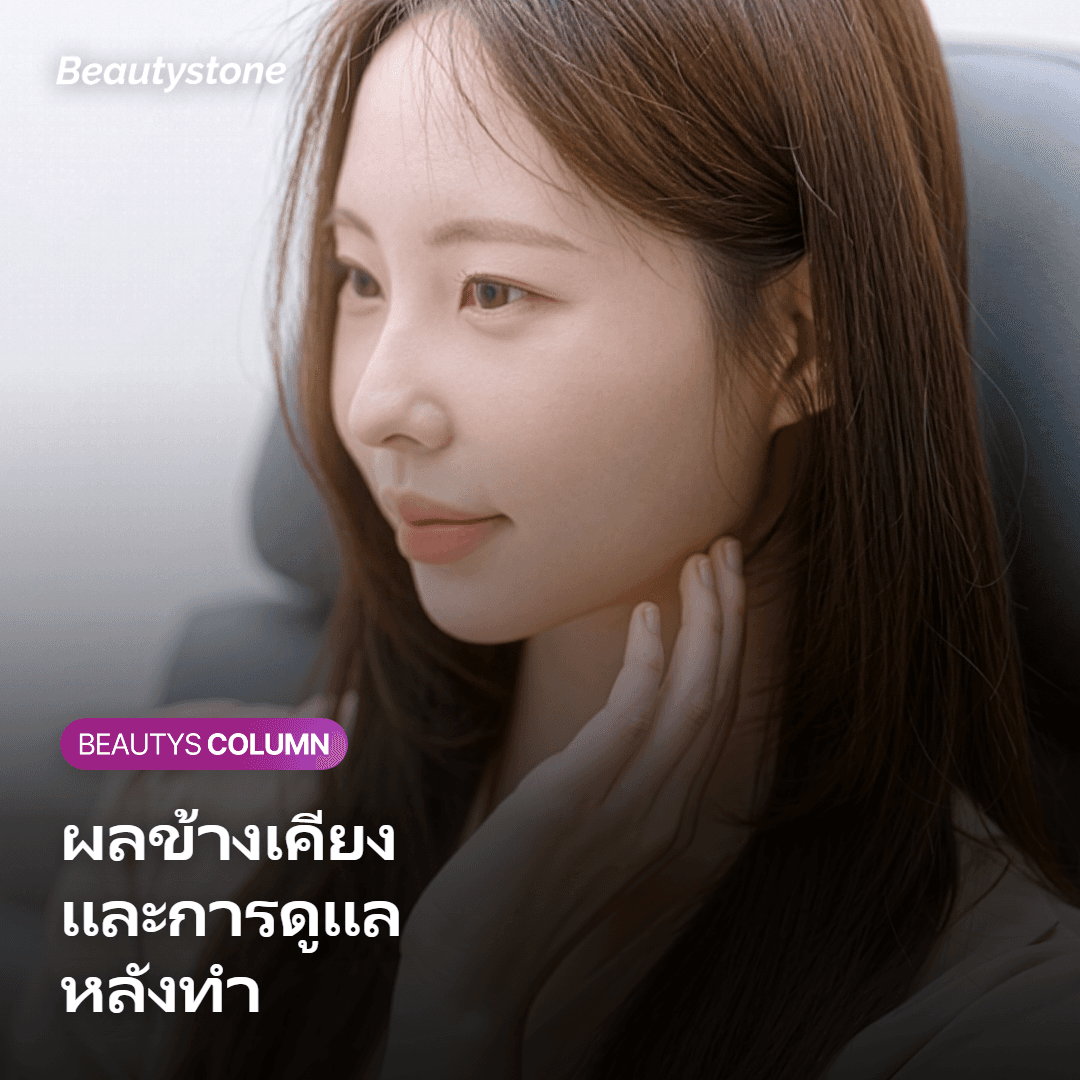 ภาพแสดงข้อควรระวังและการดูแลหลังทำ Potenza