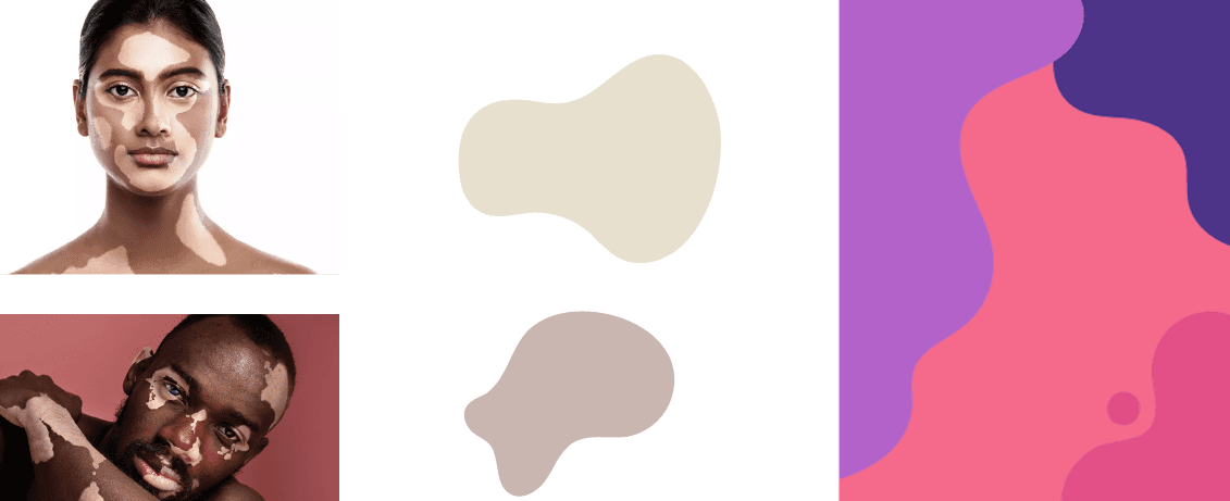 Dermato Logic Vitiligone Brand Identity Rationale